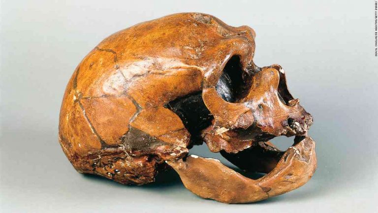 Alexander's disease spillover discovery in 'vampire' Neanderthal